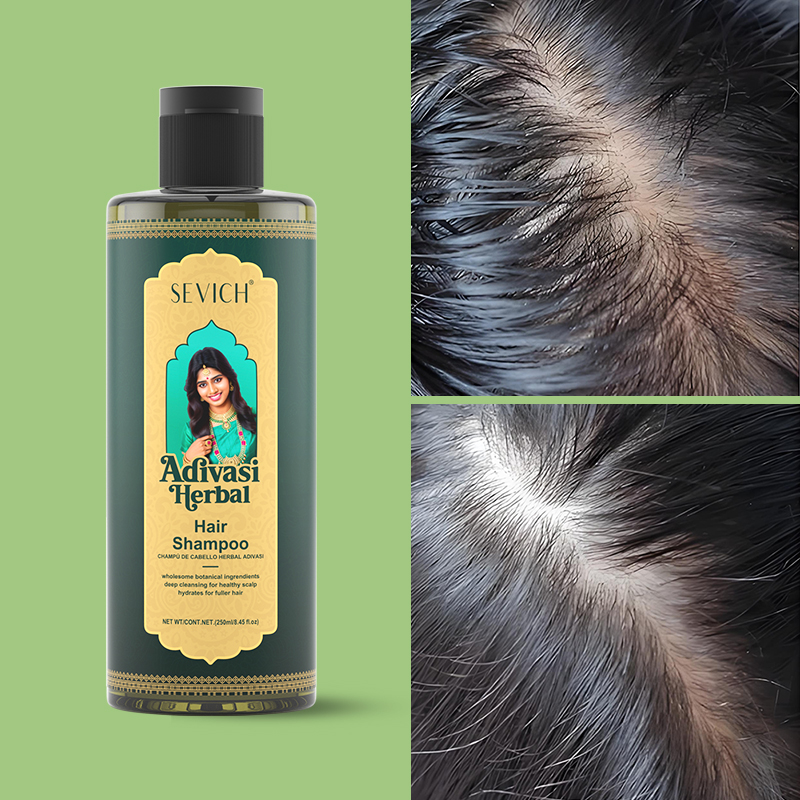 SEVICH ハーブ育毛オイルセットアーユルヴェーダ高速発毛 - Hair Care India のレビューと価格