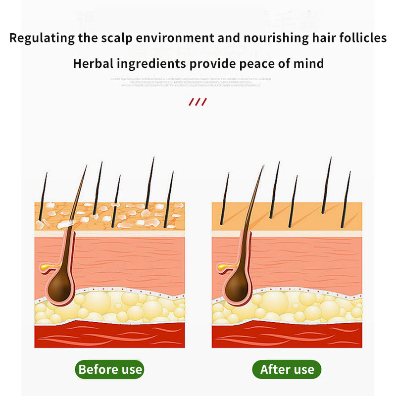 槐の毛包クリームは、損傷した毛包と頭皮の詰まりを和らげます  - Hair Care Oil のレビューと価格